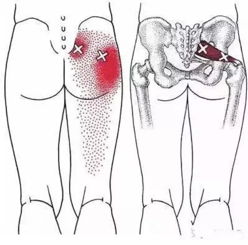 臀部大腿根疼,有可能是它出了问题