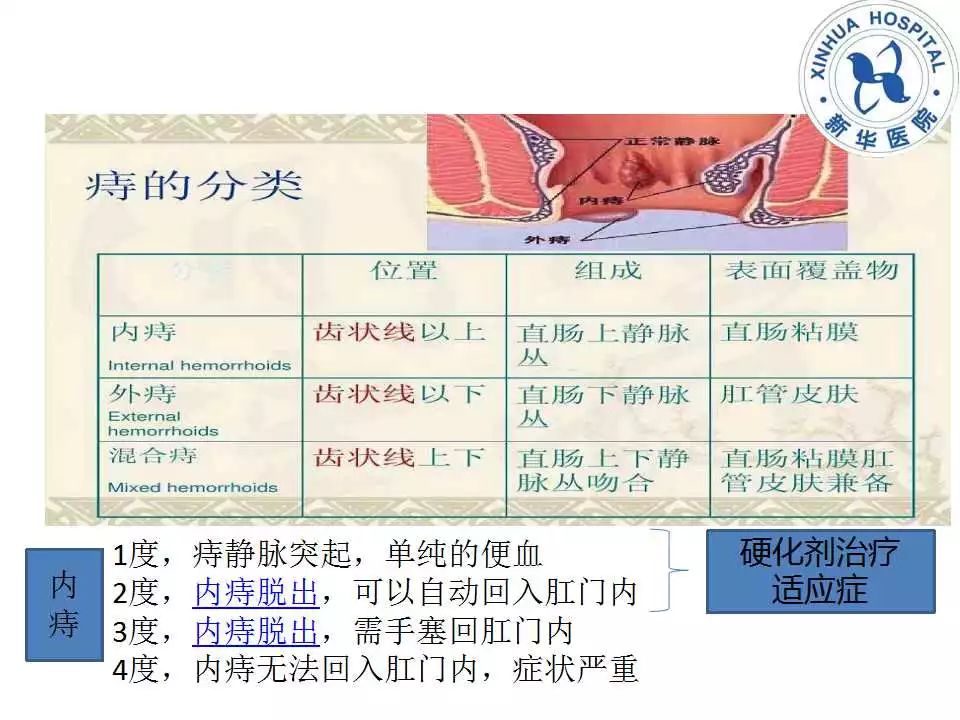 教学ppt内镜下内痔硬化剂治疗