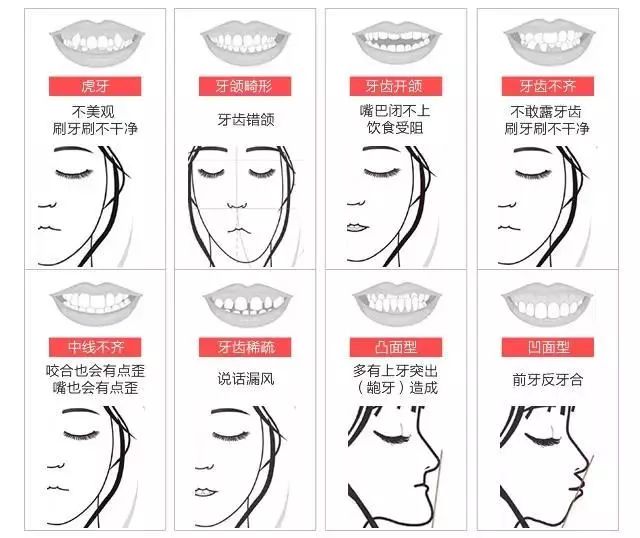 牙什么嘴成语_成语故事简笔画(3)