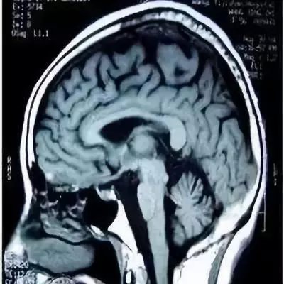 昌邑人口萎缩_昌邑一中图片(2)