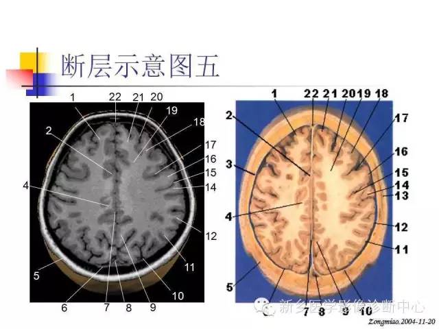 脑磁共振局部解剖功能图解