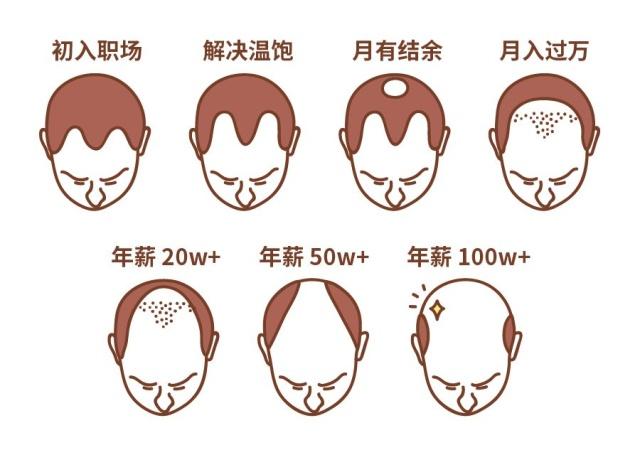 雄性激素源性脱发治不好?感觉头发越掉越多?