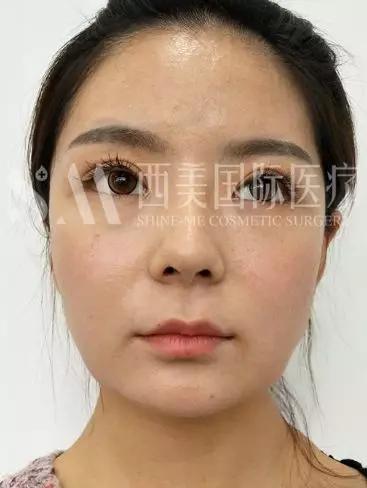 740cc9490ad9460eba8219847677f3c2.JPG