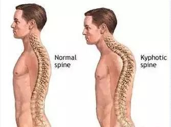 如何才能长胸 77871b41cf5d4b9d81bc2b7f45735d72.jpeg