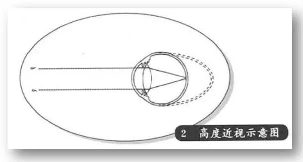 眼睛成像的原理是什么简短_眼睛的成像原理是什么(3)