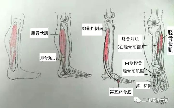 踝关节相关肌群解剖(作图:康峰:足下垂是由小腿的前肌群和外侧肌群