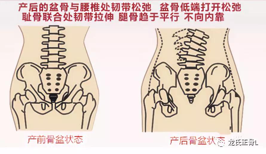 什么肌骨成语_成语故事图片(3)