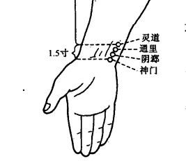 输穴,原穴-神门(土)