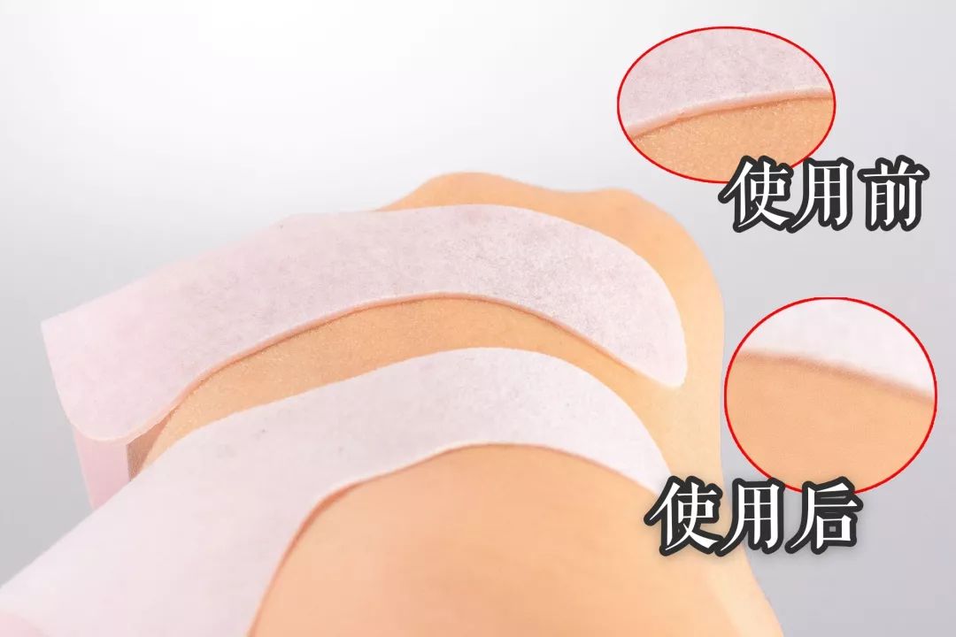 怎么睡觉才没有法令纹 55c50f8fe5564268885dd95b09fdf6ce.jpeg