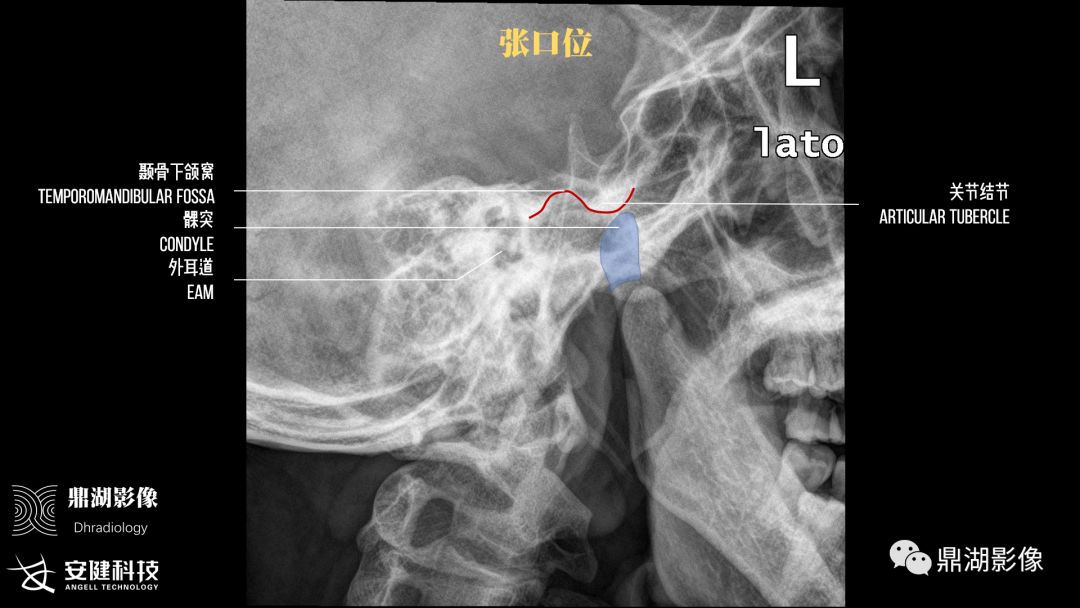 x线高清图谱 精致颞下颌关节解剖