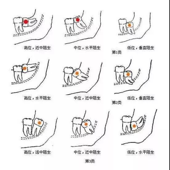 成语噙齿戴什么_成语故事图片(3)