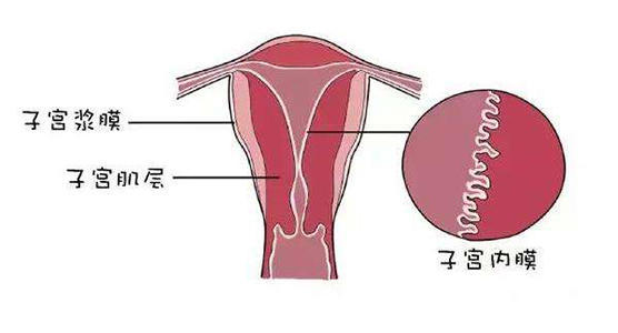 多发生于30—40岁的妇女,异位的子宫内膜受卵巢激素的影响,也发生周期