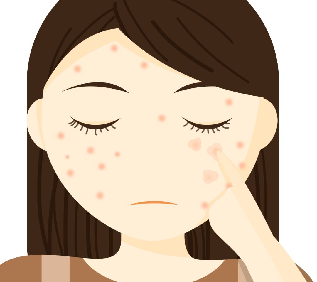 长色斑是什么原因呢 祛斑什么方法好