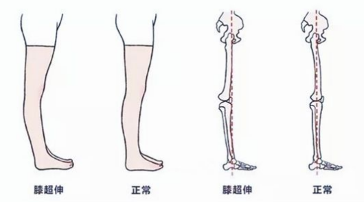 b757e6b112e74550b86b54f91ca867fd.png