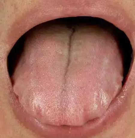 「儿康堂」脾虚有4种，你家孩子是哪种？找到合适的养脾方才最重要！