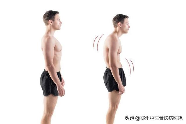 如何才能不驼背 decba6a6a8fa459b859523a99da7b0f5.jpeg