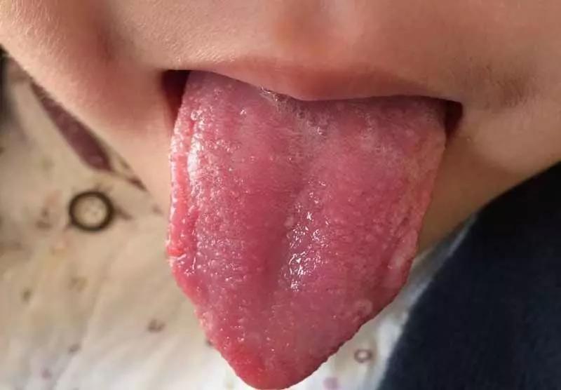 「儿康堂」脾虚有4种，你家孩子是哪种？找到合适的养脾方才最重要！