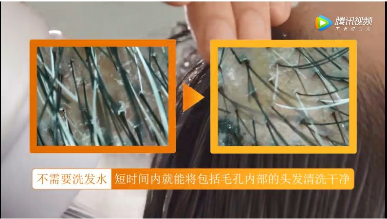 源,电,即可随时随地使用,无需任何皂液,纳米级超细水分子直接进入发囊