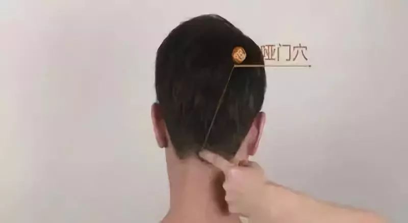 十二,哑门穴:误针出现喑哑,或晕厥如死,宜速刺人中二分,上下提插捻动