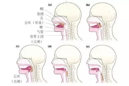 啥是二型呼吸衰竭 e2a548eb0d604f599739e5aa6d673df1.jpeg