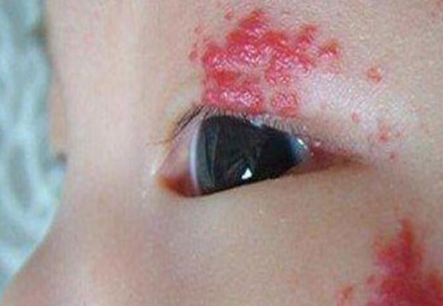 GDP是什么神经系统瘤_白带是什么图片(3)