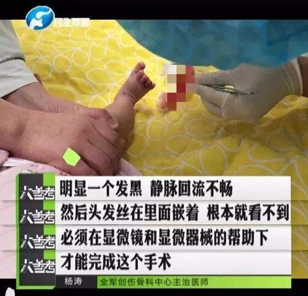 「糖果妈妈」原创1岁宝宝脚趾有“虫子”，宝妈带去医院检查，医生：怎么当妈的