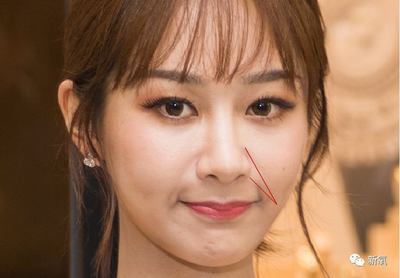 杨紫脸又变了?鼻基底假体厚到合不上嘴!变猴型