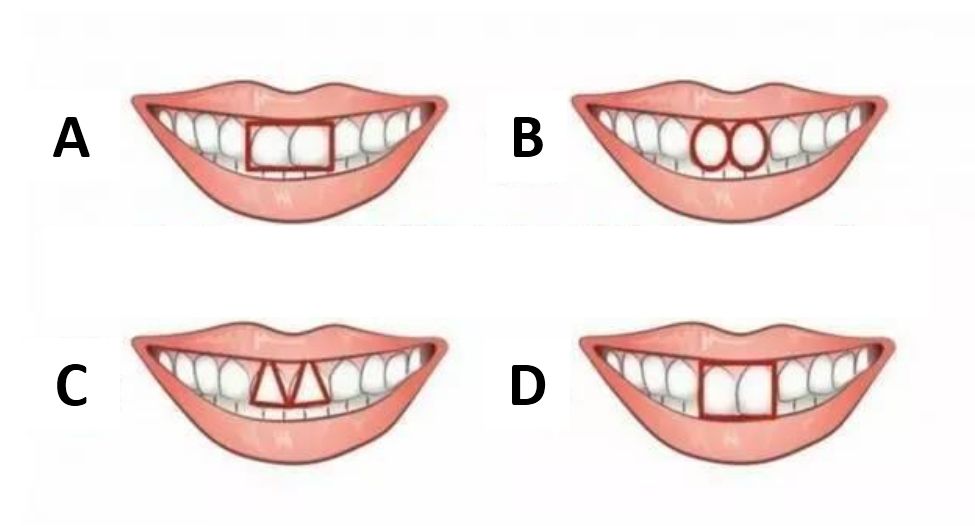 照照镜子,看你的门牙是下图中的哪一种?开始测试