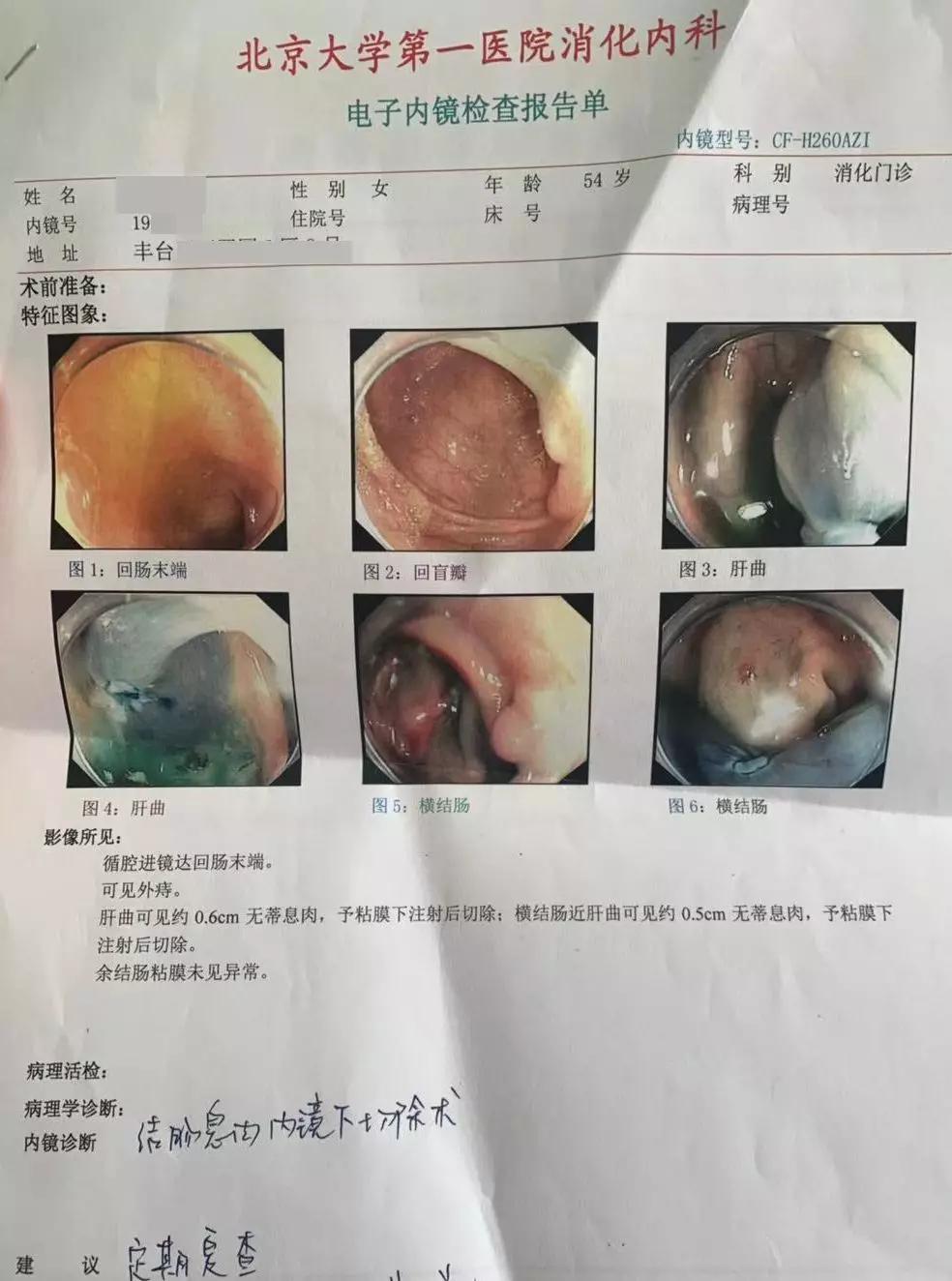 (王阿姨肠镜报告图)