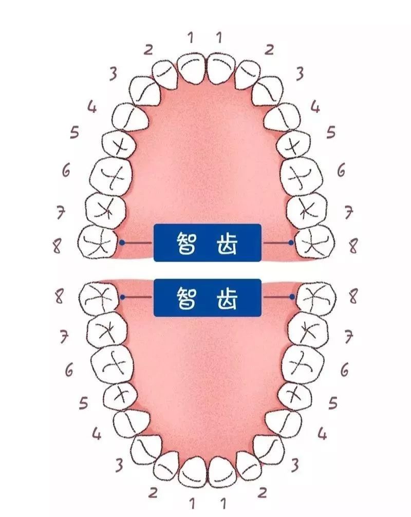 智齿一定要拔掉吗?