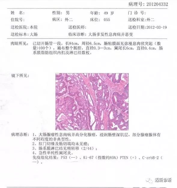 病理诊断对于肿瘤患者意义重大无可替代