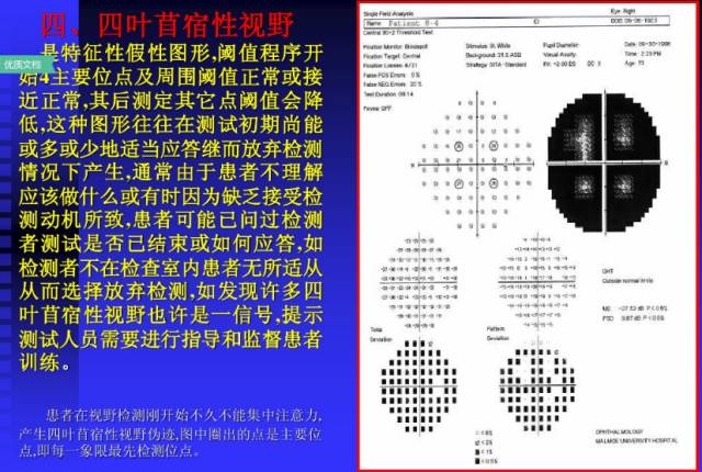 视野检查结果分析基础知识