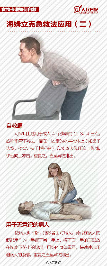 北青网：护士用海姆立克法60秒救回男童 这种方法到底怎样操作？