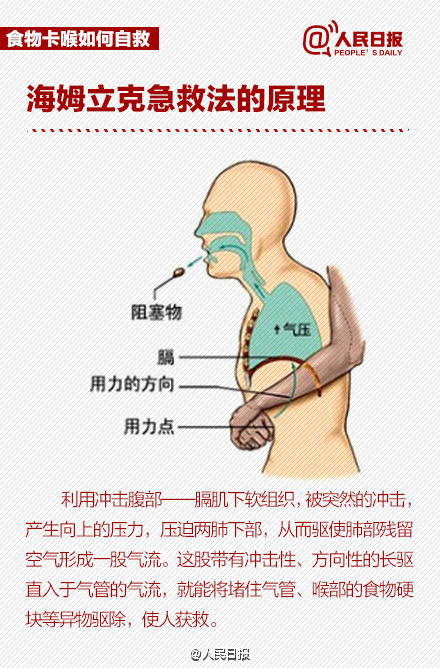 北青网：护士用海姆立克法60秒救回男童 这种方法到底怎样操作？