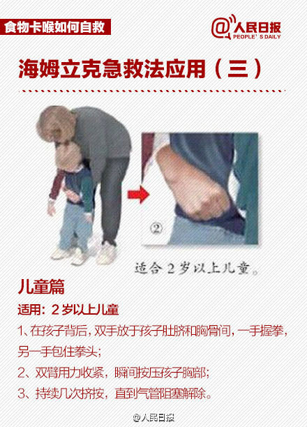 北青网：护士用海姆立克法60秒救回男童 这种方法到底怎样操作？