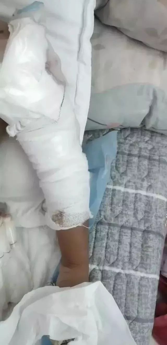 杨栋梁表示,已经给孩子缝合了伤口并且进行了包扎,由于孩子年龄比较