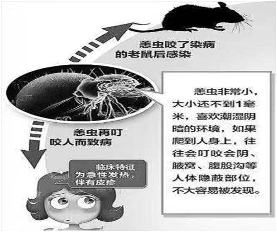 恙虫病又称丛林斑疹伤寒,是一种由恙虫病立克次体引起的急性传染病,是