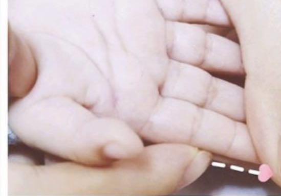 宝宝便秘，新灵老师这几招轻松解决