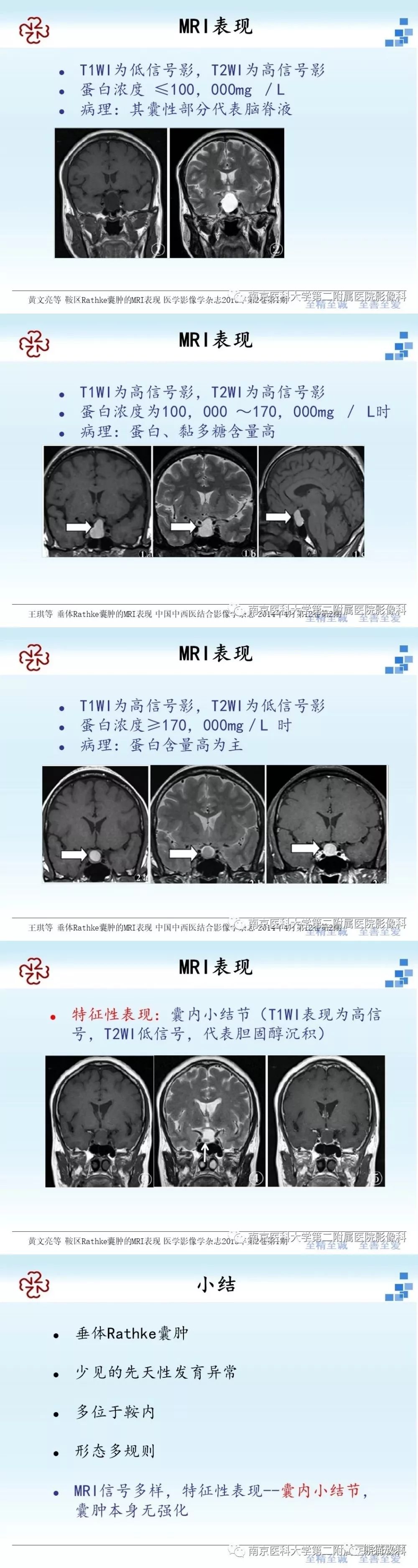 鞍区t1高信号病变之rathke囊肿丨小打卡读片精选27