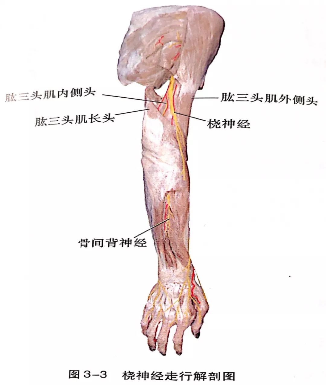 (图3-2,图3-3)随后,桡神经沿肱三头肌长头腱前方向远端走行.