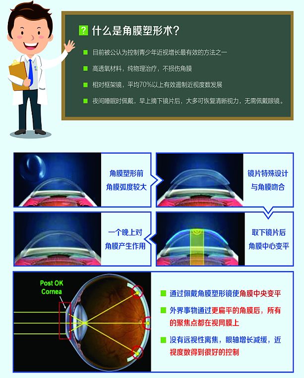 怎样有效控制近视度数增长 66c1e26f936f4d12afe18a7df42ca7f1.jpeg