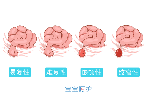 「宝宝呵护」宝宝隐私部位有个“包”，竟会影响宝宝的生育能力？