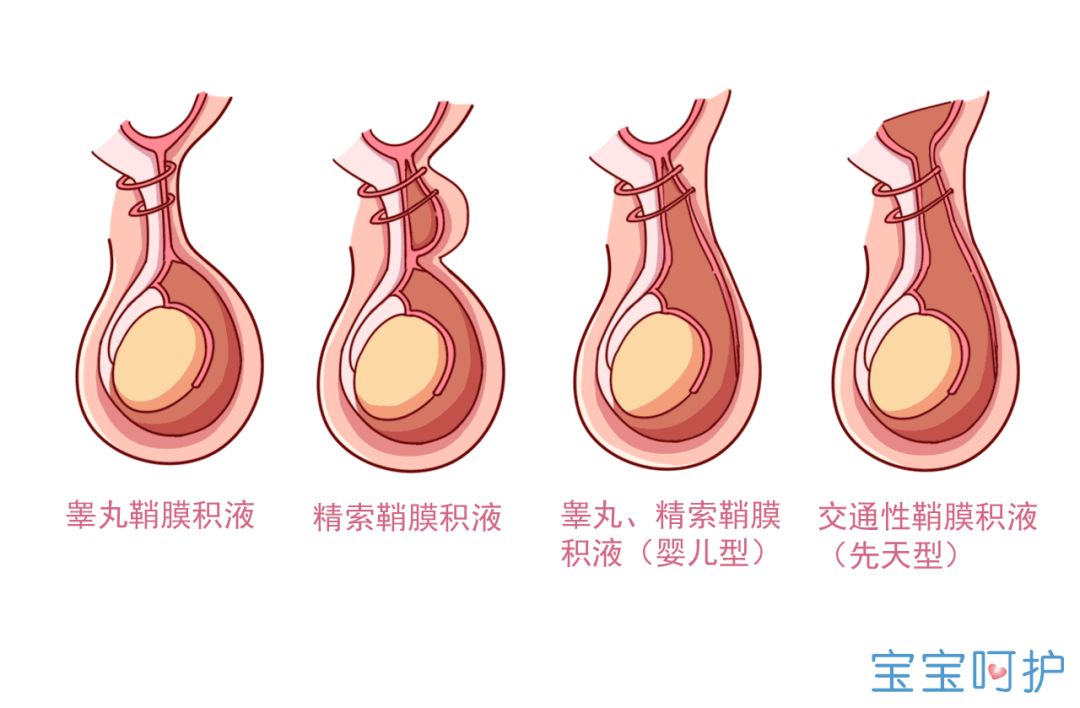 私密长了个大包怎么办