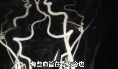梦见蛇咬了自己的手，梦境背后的深层解析与心理启示