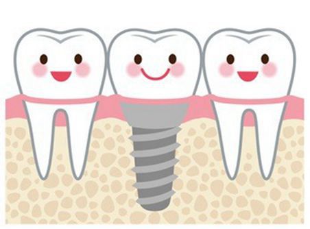 种牙最佳年龄限制 1dc79e1d20c24070bb1329af9d70591f.jpeg