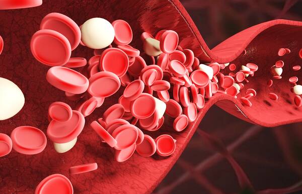 高密度脂蛋白与低密度脂蛋白关系 525e277c906d41179f7cca30816a8c01.jpeg