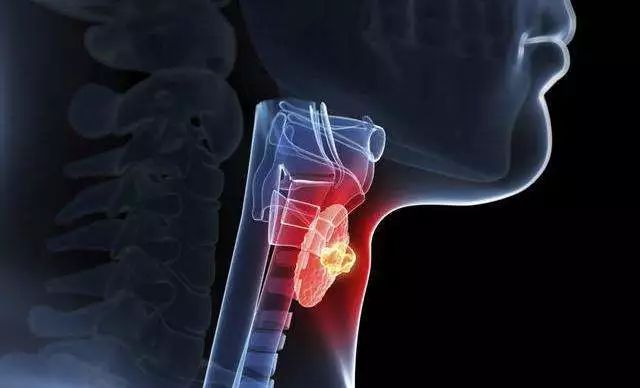 癌症怎么传染的 75e55e97feda439790624d05ee5464d4.jpeg