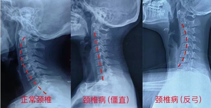 什么是生理因素 d346c075e8674212aa55b4b5b39e750f.jpeg