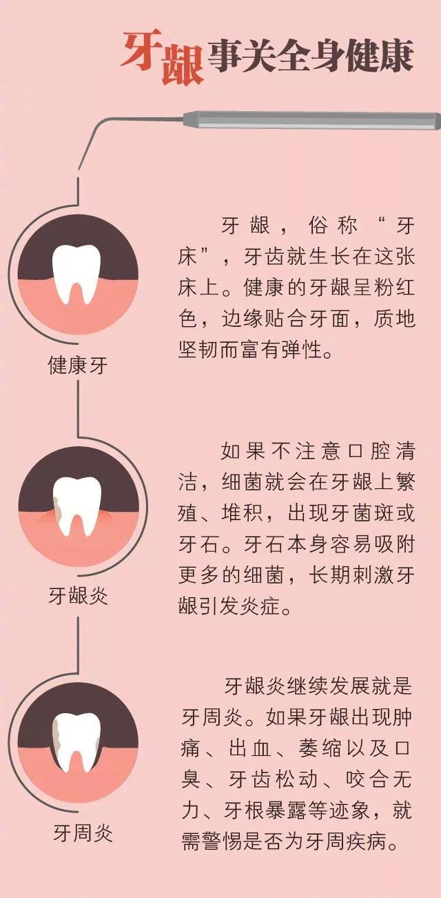一张图测出你的"牙龈健康指数,摆脱牙龈危机