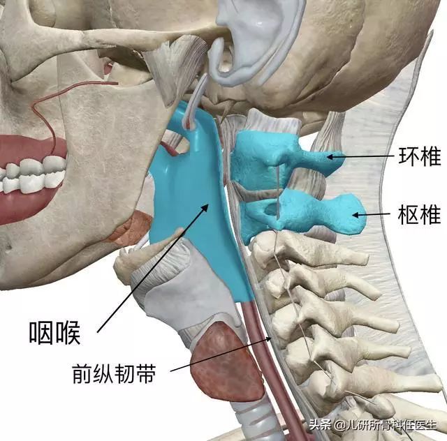 孩子突然歪脖子 儿童肌性斜颈与环枢椎半脱位的区别-图片8